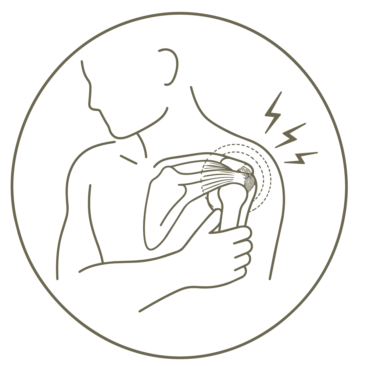 Rotator Cuff Syndrome